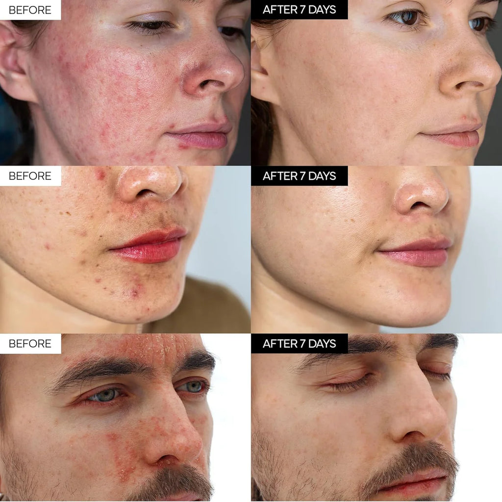 iVoskin Intensive Cica Repair Cream | كريم إيفوسكين المكثف لإصلاح البشرة